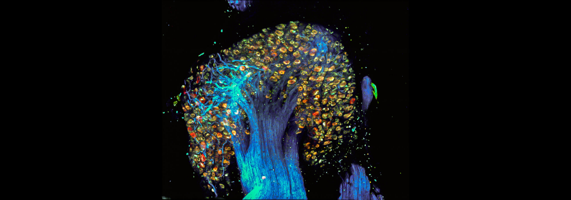 "Tree of Pain" – Image of Dorsal Root Ganglion labelled by PainBow
